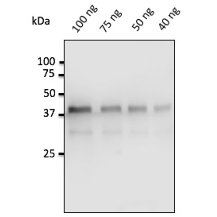 Western Blot - Anti-Pepsin Antibody (AB0197) - Antibodies.com