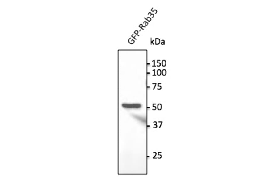 Western Blot - Anti-RAB35 Antibody (AB0198) - Antibodies.com