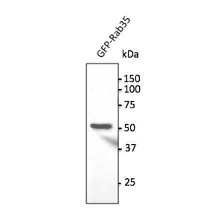 Western Blot - Anti-RAB35 Antibody (AB0198) - Antibodies.com