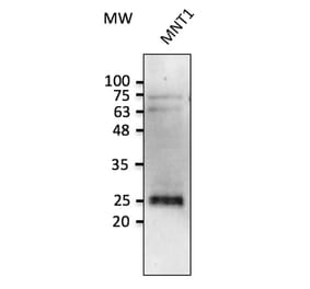 Western Blot - Anti-RAB38 Antibody (AB0242) - Antibodies.com