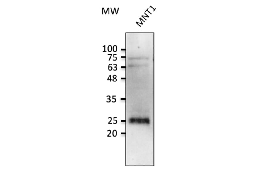 Western Blot - Anti-RAB38 Antibody (AB0242) - Antibodies.com