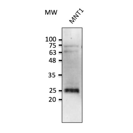 Western Blot - Anti-RAB38 Antibody (AB0242) - Antibodies.com