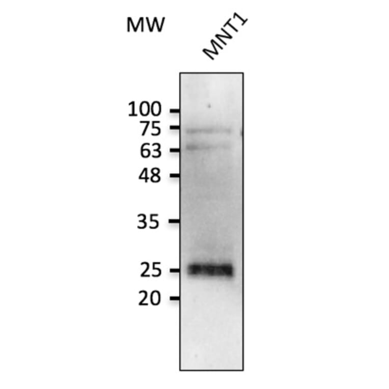 Western Blot - Anti-RAB38 Antibody (AB0242) - Antibodies.com
