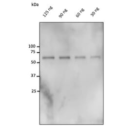 Western Blot - Anti-Catalase Antibody (AB0245) - Antibodies.com