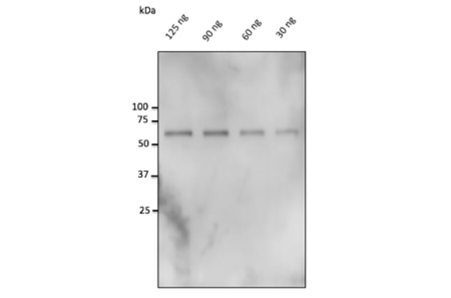 Western Blot - Anti-Catalase Antibody (AB0245) - Antibodies.com