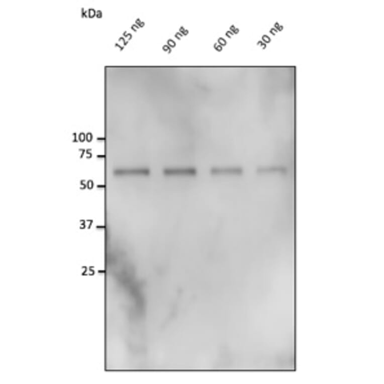 Western Blot - Anti-Catalase Antibody (AB0245) - Antibodies.com