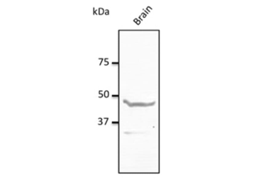 Western Blot - Anti-NPY1R Antibody (AB0277) - Antibodies.com