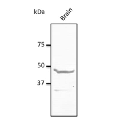 Western Blot - Anti-NPY1R Antibody (AB0277) - Antibodies.com