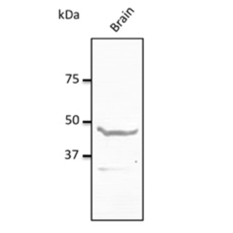 Western Blot - Anti-NPY1R Antibody (AB0277) - Antibodies.com