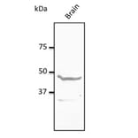 Western Blot - Anti-NPY1R Antibody (AB0277) - Antibodies.com