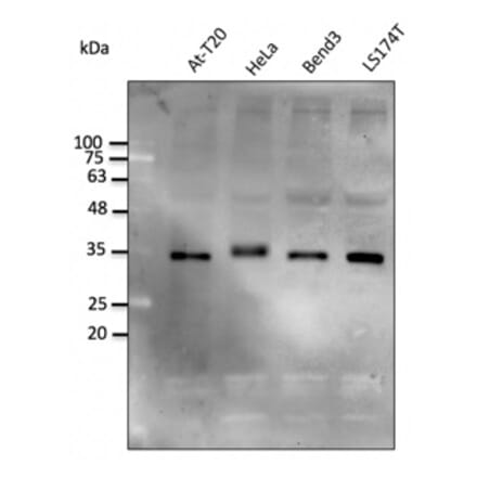 Western Blot - Anti-STUB1 Antibody (AB0283) - Antibodies.com