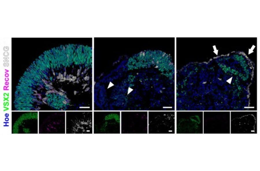 Immunofluorescence - Anti-SNCG Antibody - Antibodies.com