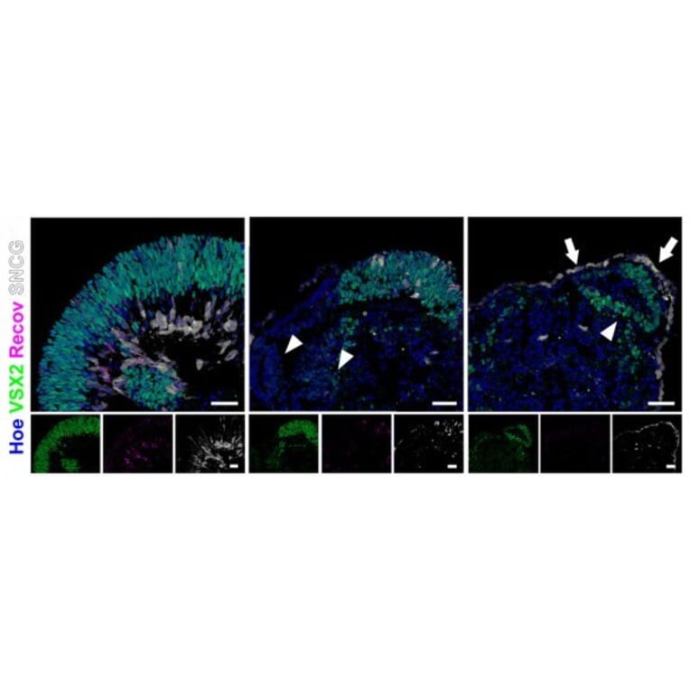 Immunofluorescence - Anti-SNCG Antibody - Antibodies.com