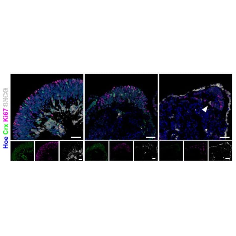 Immunofluorescence - Anti-SNCG Antibody - Antibodies.com