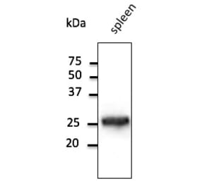 Western Blot - Anti-RAB5 Antibody (AB1024) - Antibodies.com