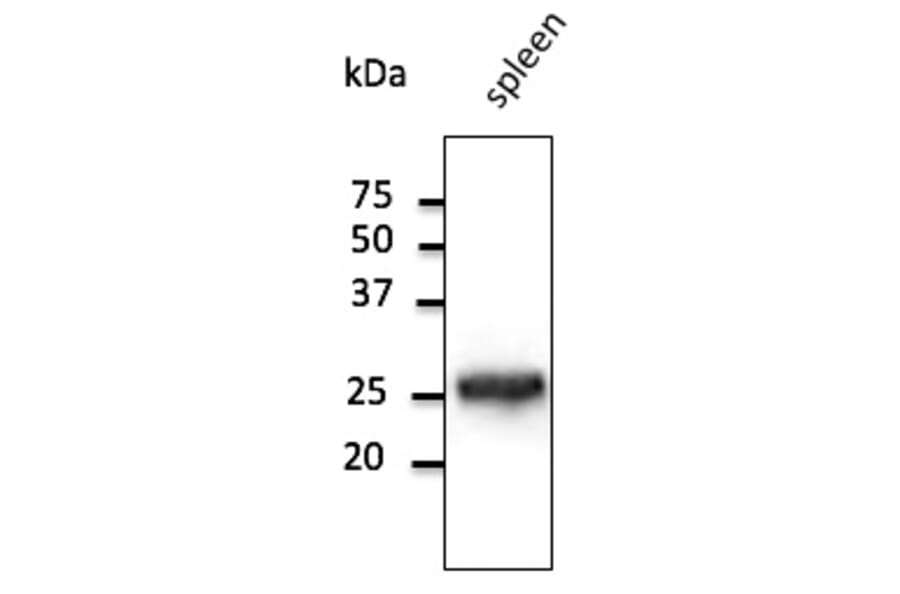 Western Blot - Anti-RAB5 Antibody (AB1024) - Antibodies.com