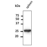 Western Blot - Anti-RAB5 Antibody (AB1024) - Antibodies.com