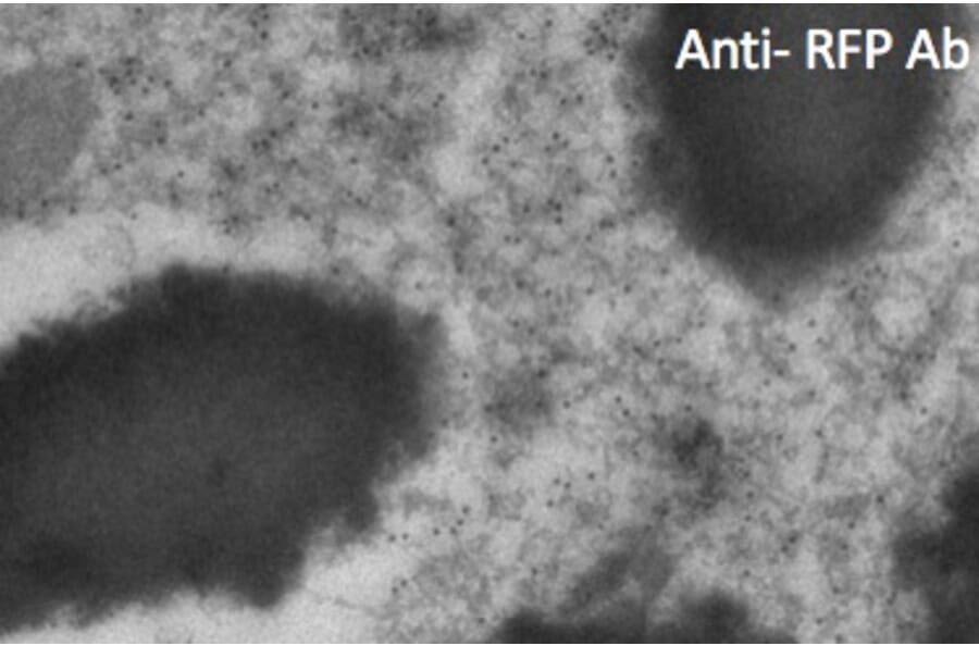 Immune Electron Microscopy - Anti-RFP Antibody (AB1140) - Antibodies.com