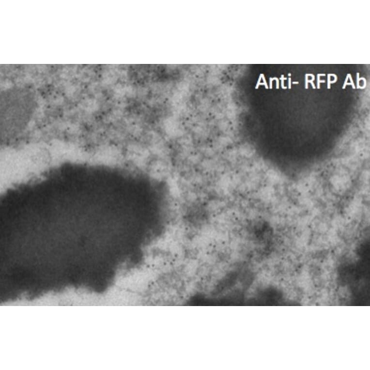 Immune Electron Microscopy - Anti-RFP Antibody (AB1140) - Antibodies.com