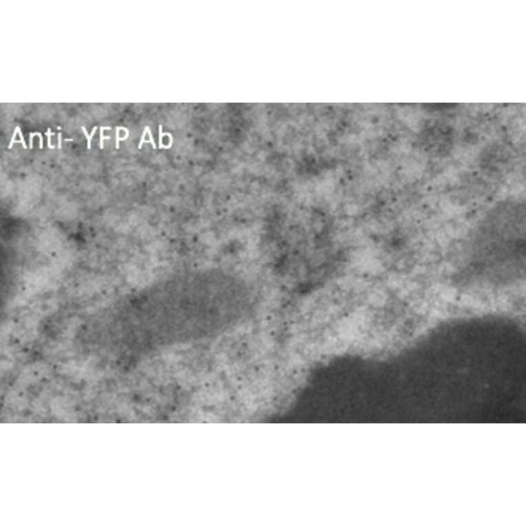 Immune Electron Microscopy - Anti-YFP Antibody (AB1166) - Antibodies.com