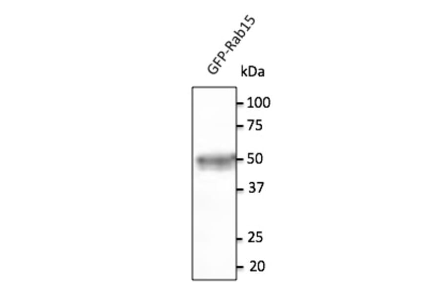 Western Blot - Anti-RAB15 Antibody (AB169170) - Antibodies.com