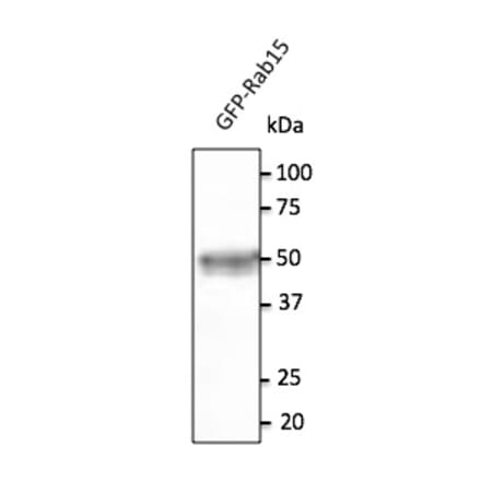 Western Blot - Anti-RAB15 Antibody (AB169170) - Antibodies.com
