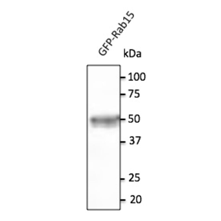 Western Blot - Anti-RAB15 Antibody (AB169170) - Antibodies.com