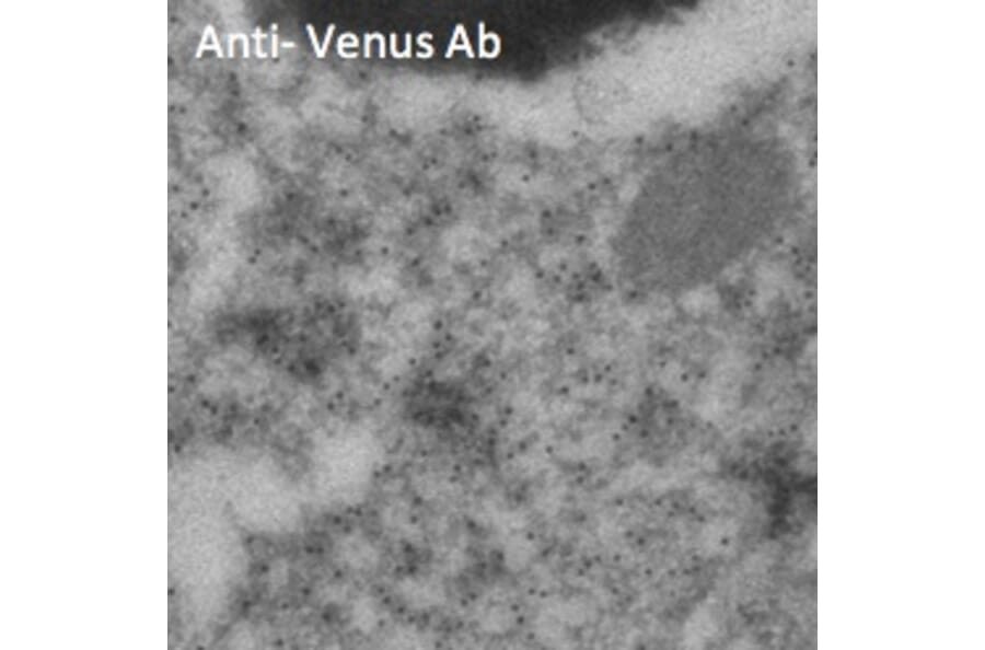 Immune Electron Microscopy - Anti-Venus Antibody (AB2166) - Antibodies.com