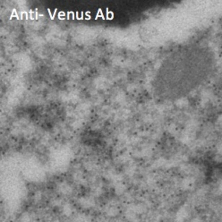 Immune Electron Microscopy - Anti-Venus Antibody (AB2166) - Antibodies.com