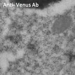 Immune Electron Microscopy - Anti-Venus Antibody (AB2166) - Antibodies.com