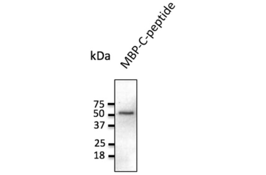 Western Blot - Anti-C Peptide Antibody (AB236237) - Antibodies.com