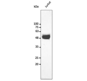 Western Blot - Anti-CD2 Antibody (AB240241) - Antibodies.com