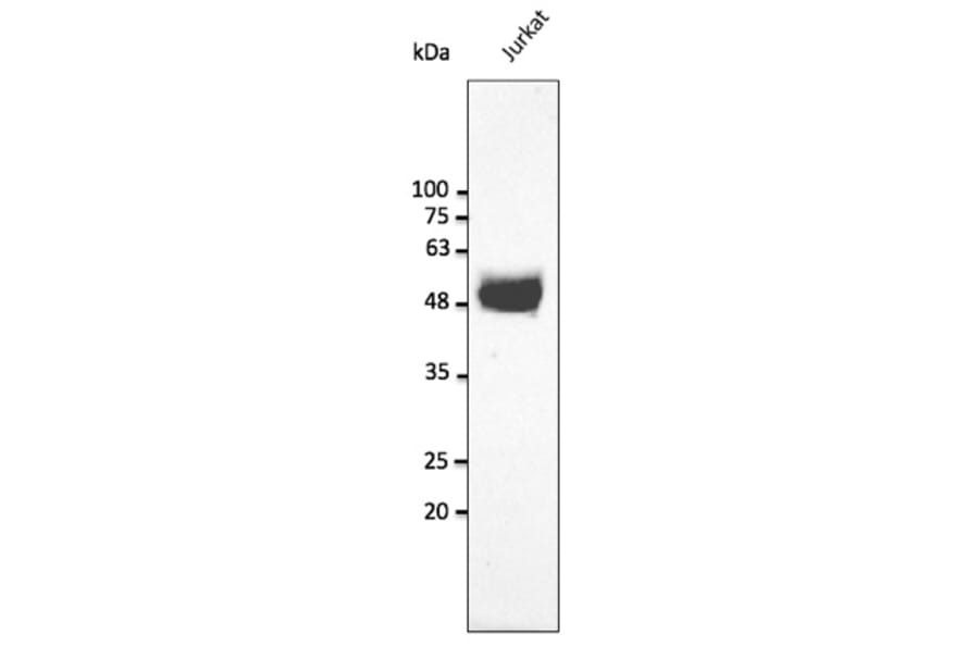 Western Blot - Anti-CD2 Antibody (AB240241) - Antibodies.com