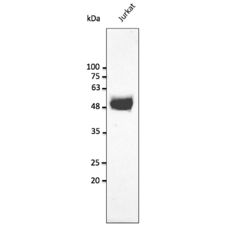 Western Blot - Anti-CD2 Antibody (AB240241) - Antibodies.com