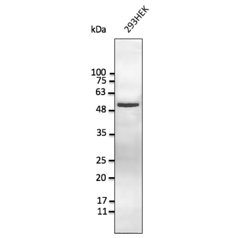 Western Blot - Anti-Vimentin Antibody (AB252253) - Antibodies.com
