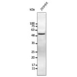 Western Blot - Anti-Vimentin Antibody (AB252253) - Antibodies.com