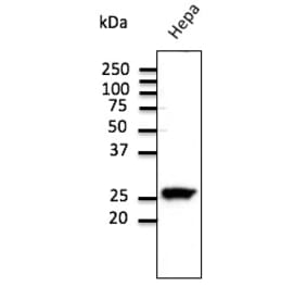 Western Blot - Anti-RAB11 Antibody (AB3035) - Antibodies.com