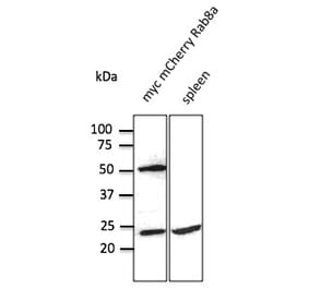 Western Blot - Anti-RAB8 Antibody (AB3176) - Antibodies.com