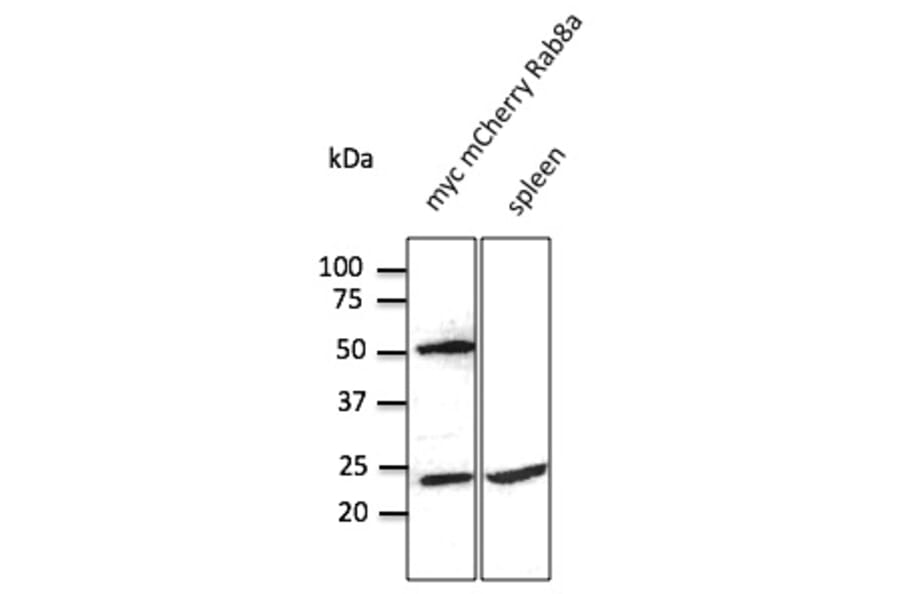 Western Blot - Anti-RAB8 Antibody (AB3176) - Antibodies.com