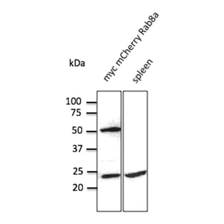Western Blot - Anti-RAB8 Antibody (AB3176) - Antibodies.com
