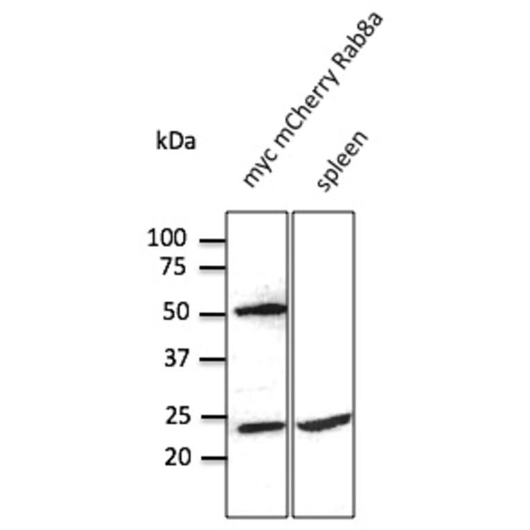 Western Blot - Anti-RAB8 Antibody (AB3176) - Antibodies.com
