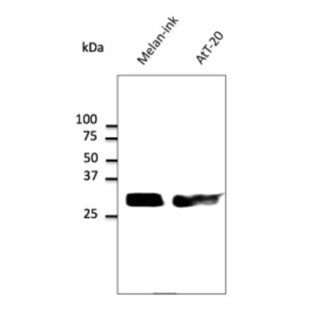 Western Blot - Anti-RAB27 Antibody (AB7223) - Antibodies.com