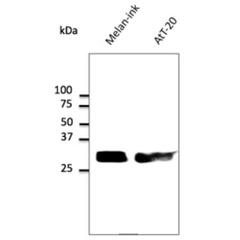 Western Blot - Anti-RAB27 Antibody (AB7223) - Antibodies.com