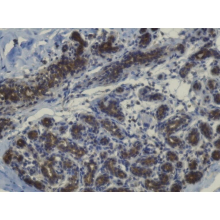 Immunohistochemistry - Anti-RAB27 Antibody (AB7223) - Antibodies.com