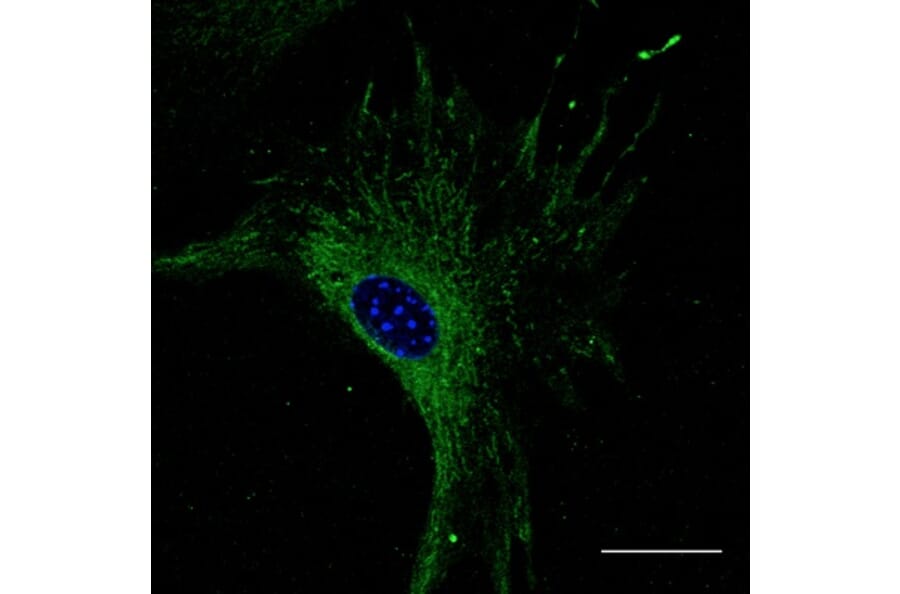 Immunoflouroscence - Anti-RAB27 Antibody (AB7223) - Antibodies.com