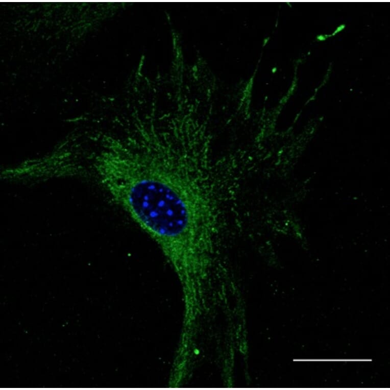 Immunoflouroscence - Anti-RAB27 Antibody (AB7223) - Antibodies.com