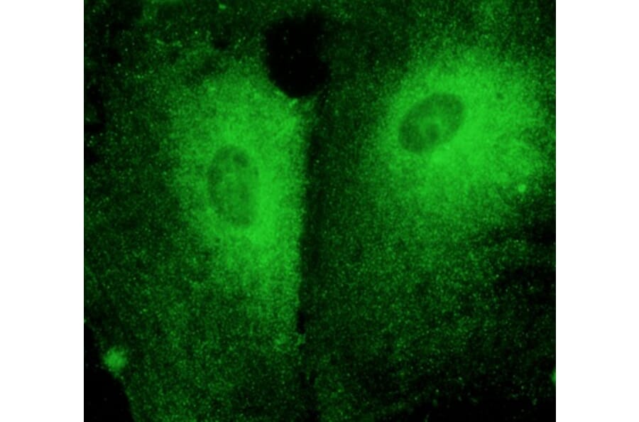 Immunoflouroscence - Anti-RAB27 Antibody (AB7223) - Antibodies.com