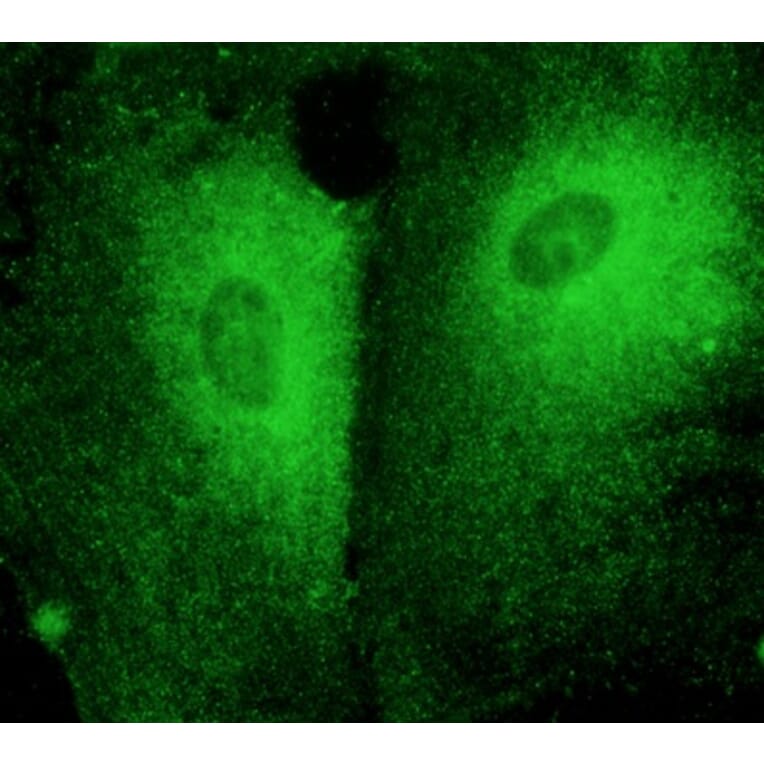 Immunoflouroscence - Anti-RAB27 Antibody (AB7223) - Antibodies.com