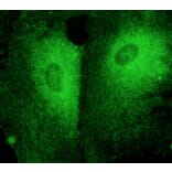 Immunoflouroscence - Anti-RAB27 Antibody (AB7223) - Antibodies.com