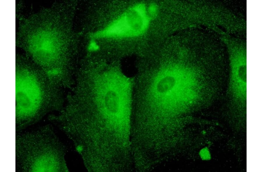 Immunoflouroscence - Anti-RAB27 Antibody (AB7223) - Antibodies.com
